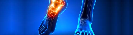 bokaízület gyulladás hogyan kezeljük a jobb láb lábának ízületében a fájdalom oka